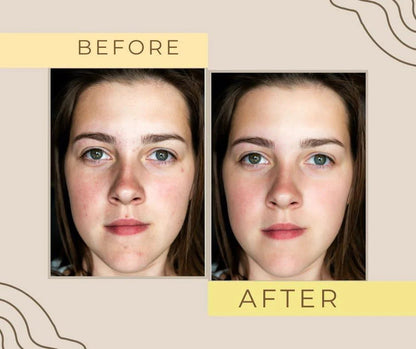 Gold Glow & White Korean Whitening Cream