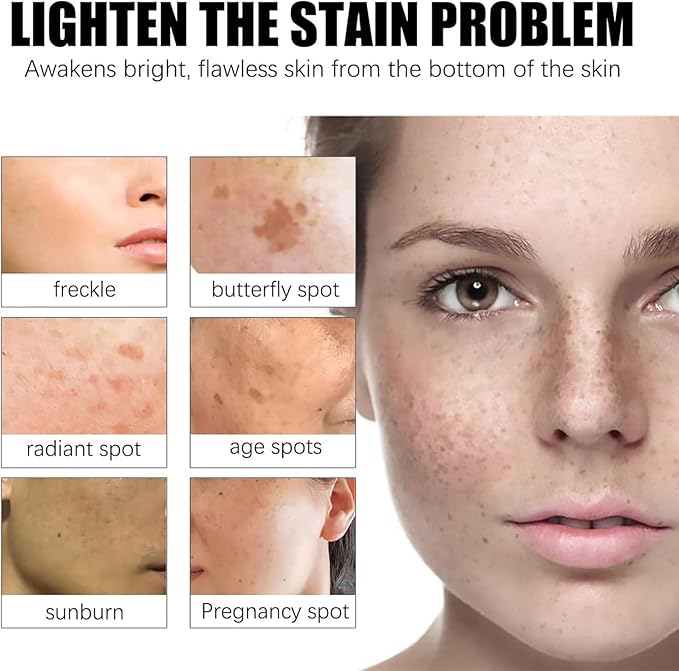 Ezrch Spot Fading Urea Cream