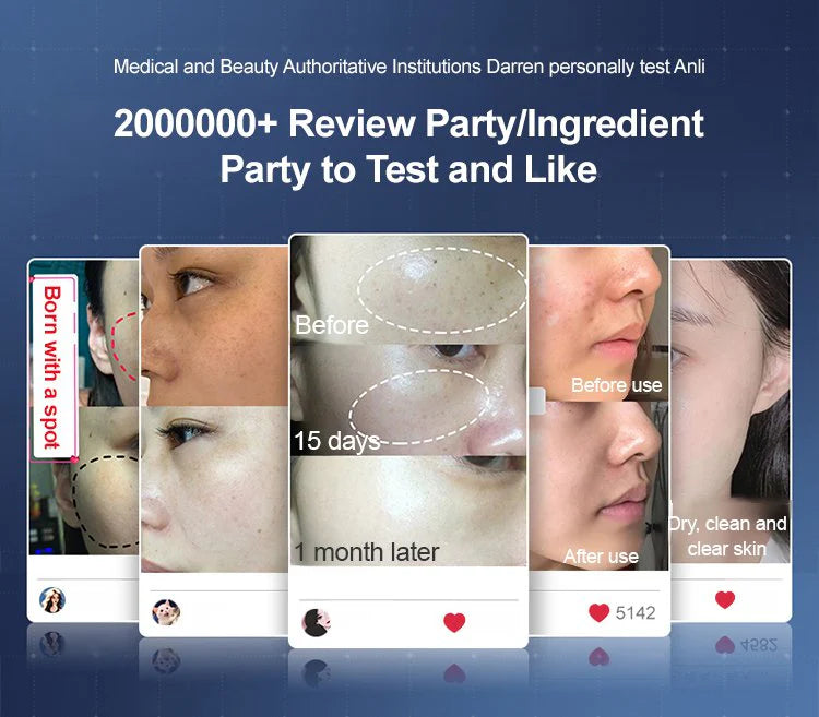 Ezrch Spot Fading Urea Cream