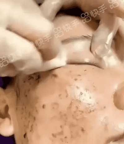 Ezrch Spot Fading Urea Cream