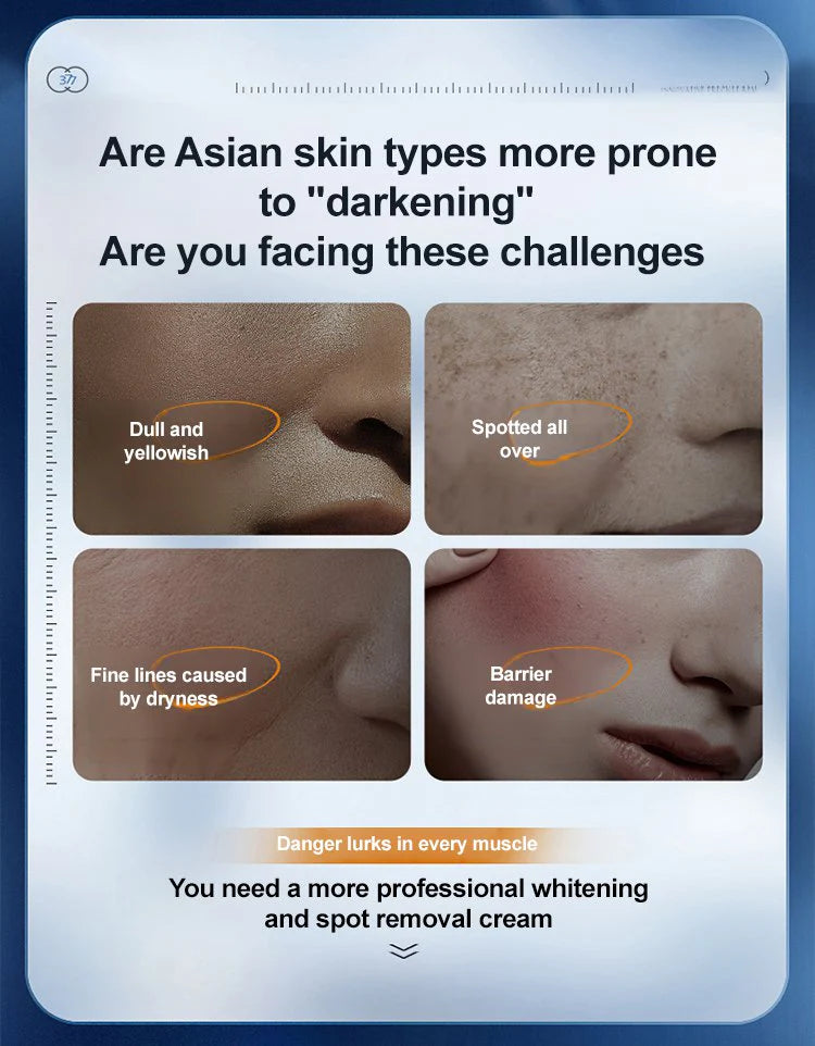 Ezrch Spot Fading Urea Cream