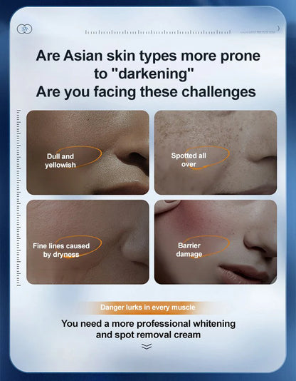 Ezrch Spot Fading Urea Cream